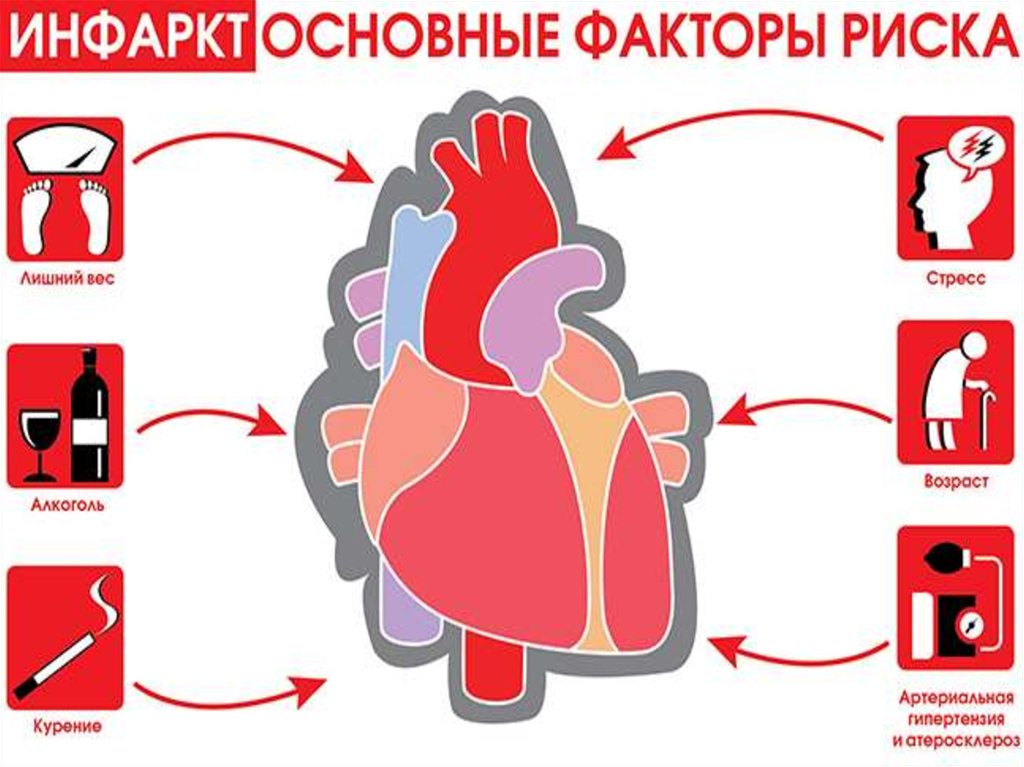 Treatment of myocardial infarction
