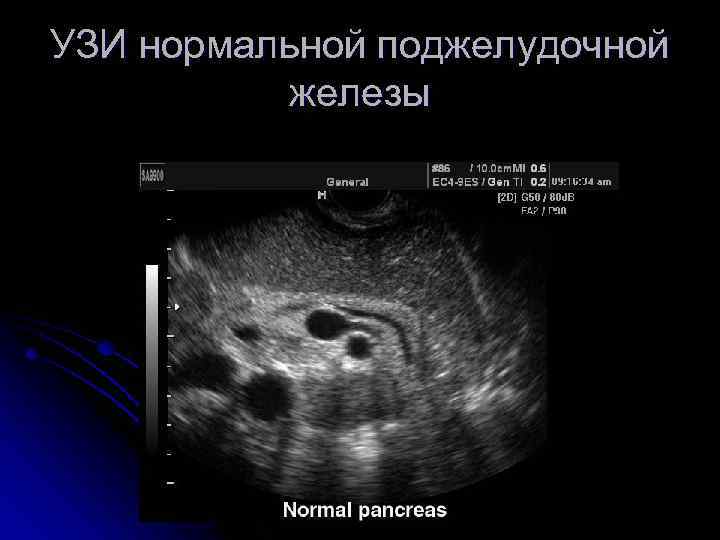 Ultrasound of the kidneys and bladder