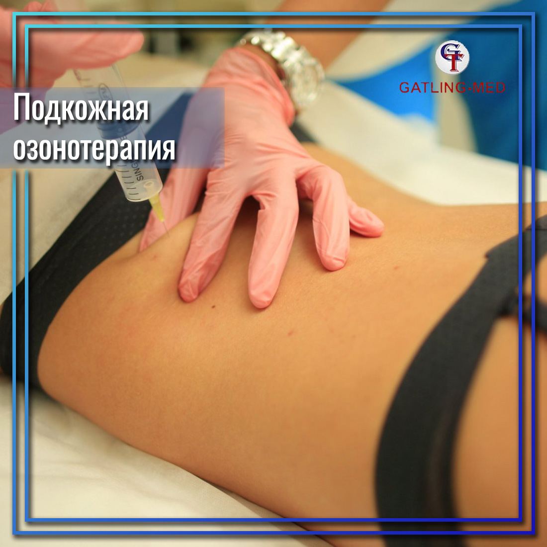 Subcutaneous ozone therapy