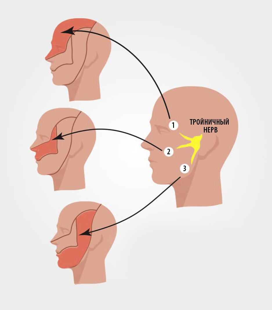 Treatment of trigeminal neuropathy 