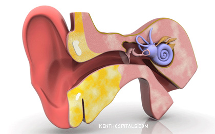 Diagnosis and treatment of ear diseases