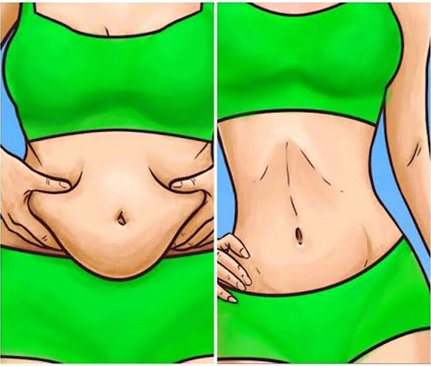 Treatment of sagging belly