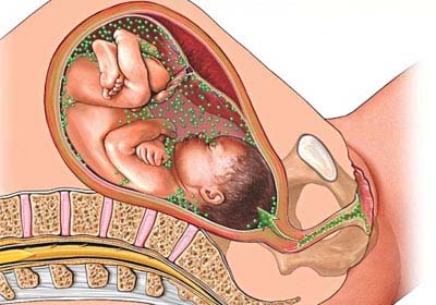 TORCH-инфекция во время беременности. Исследования