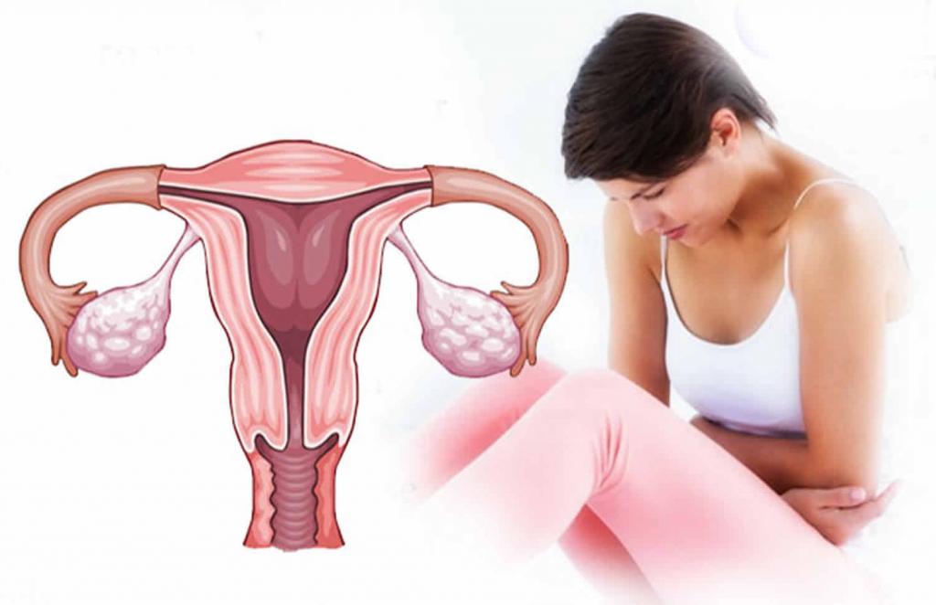 Diagnosis and treatment of dysfunctional uterine bleeding